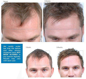 Nutrafol Men Advanced Thinning Hair & Hair Loss Supplement - 120 Capsules